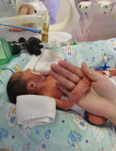 【南方都市报】出生时1斤7两，广州巴掌大早产娃疫情期连闯生死关，3个月长到6斤