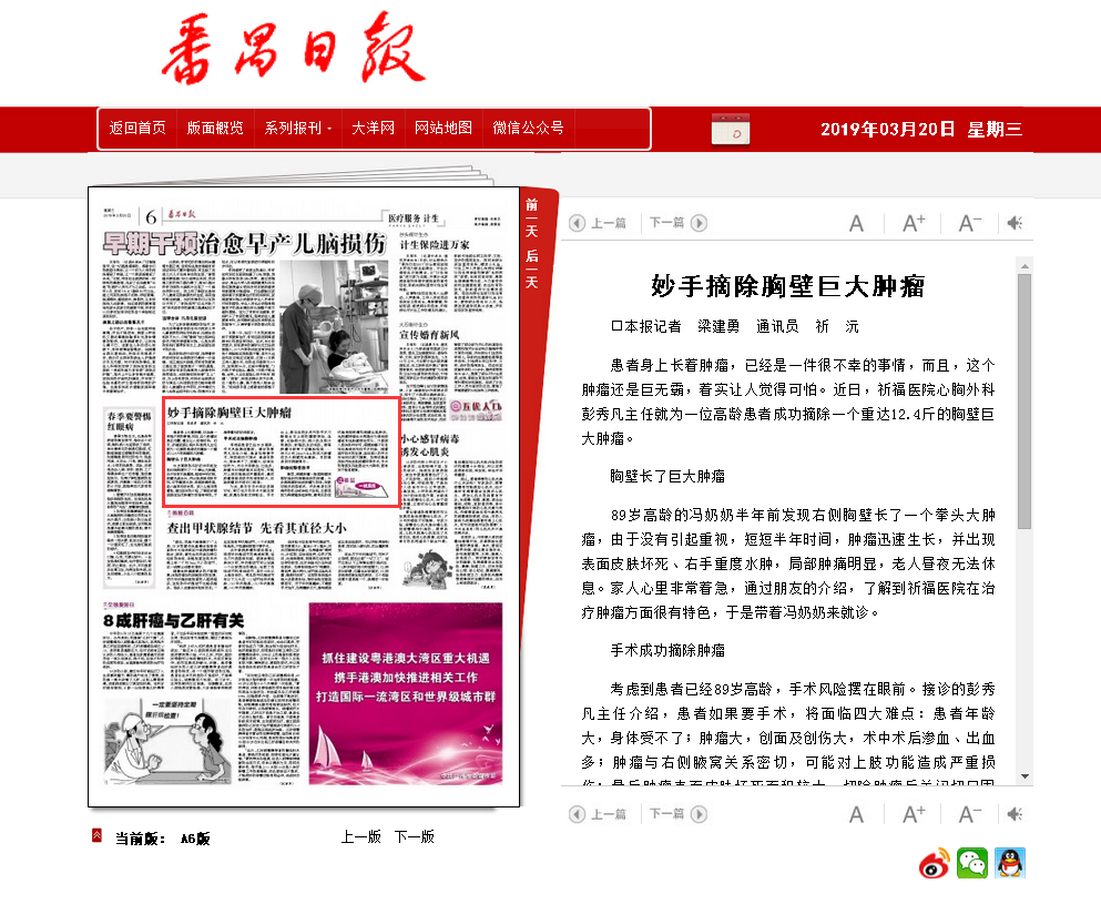 【番禺日报】妙手摘除胸壁巨大肿瘤