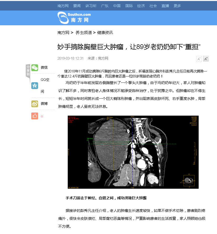 【南方网】妙手摘除胸壁巨大肿瘤，让89岁老奶奶卸下“重担”